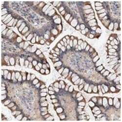 MAGEE2, Rabbit, Polyclonal Antibody, Abnova 100 &mu;L | Buy Online | Abnova Corporation | Fisher Scientific