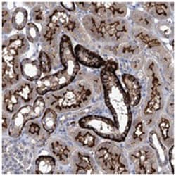 SBK2, Rabbit, Polyclonal Antibody, Abnova 100 &mu;L | Buy Online | Abnova | Fisher Scientific