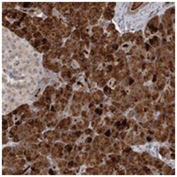 ZFP14, Rabbit, Polyclonal Antibody, Abnova 100&mu;L; Unlabeled:Antibodies,