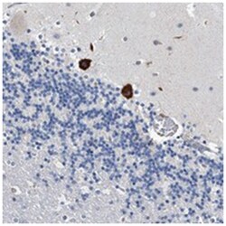 TMEM63C, Rabbit, Polyclonal Antibody, Abnova 100 &mu;L | Buy Online | Abnova Corporation | Fisher Scientific