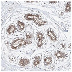 LACE1 Rabbit anti-Human, Polyclonal Antibody, Abnova 100 &mu;L | Buy Online | Abnova Corporation | Fisher Scientific