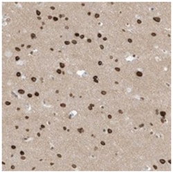 C14orf174 Rabbit anti-Human, Polyclonal Antibody, Abnova 100 &mu;L | Buy Online | Abnova Corporation | Fisher Scientific