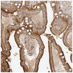 MIPEP Rabbit anti-Human, Polyclonal Antibody, Abnova 100 &mu;L | Buy Online | Abnova Corporation | Fisher Scientific