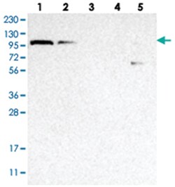 OGT Rabbit anti-Human, Mouse, Rat, Polyclonal Antibody, Abnova 100 &mu;L | Buy Online | Abnova Corporation | Fisher Scientific