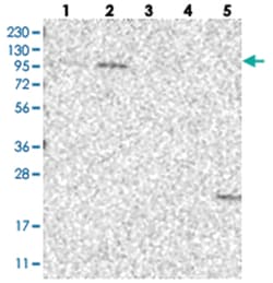 OGT Rabbit anti-Human, Polyclonal Antibody, Abnova 100&mu;L; Unlabeled:Antibodies,