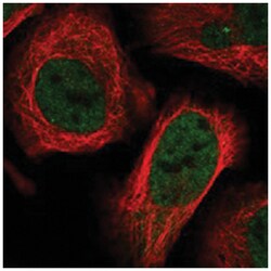 OGT Rabbit anti-Human, Polyclonal Antibody, Abnova 100&mu;L; Unlabeled:Antibodies,