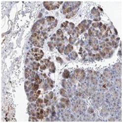 SLC25A29, Rabbit, Polyclonal Antibody, Abnova 100&mu;L; Unlabeled:Antibodies,