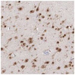 hCG_1776007, Rabbit, Polyclonal Antibody, Abnova 100 &mu;L | Buy Online | Abnova Corporation | Fisher Scientific