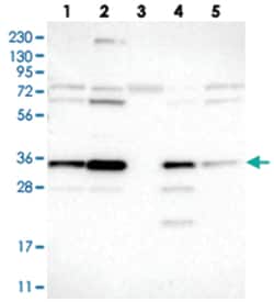 LRRC59 Rabbit anti-Human, Polyclonal Antibody, Abnova 100 &mu;L | Buy Online | Abnova Corporation | Fisher Scientific