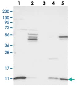 SH3BGRL3, Rabbit, Polyclonal Antibody, Abnova 100&mu;L; Unlabeled:Antibodies,