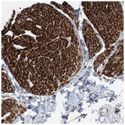 SH3BGRL3, Rabbit, Polyclonal Antibody, Abnova 100&mu;L; Unlabeled:Antibodies,