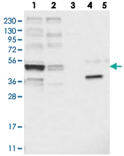 KCNJ8, Rabbit, Polyclonal Antibody, Abnova 100&mu;L; Unlabeled:Antibodies,