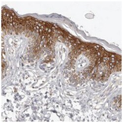 KCNJ8, Rabbit, Polyclonal Antibody, Abnova 100&mu;L; Unlabeled:Antibodies,