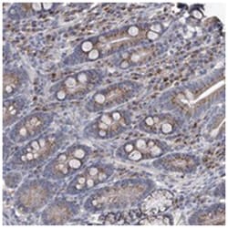 PCSK5, Rabbit, Polyclonal Antibody, Abnova 100&mu;L; Unlabeled:Antibodies,