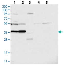 PRUNE2 Rabbit anti-Human, Polyclonal Antibody, Abnova 100 &mu;L | Buy Online | Abnova Corporation | Fisher Scientific