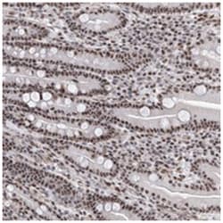 PRUNE2 Rabbit anti-Human, Polyclonal Antibody, Abnova 100 &mu;L | Buy Online | Abnova Corporation | Fisher Scientific