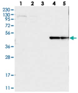 PISD Rabbit anti-Human, Polyclonal Antibody, Abnova 100 &mu;L | Buy Online | Abnova Corporation | Fisher Scientific