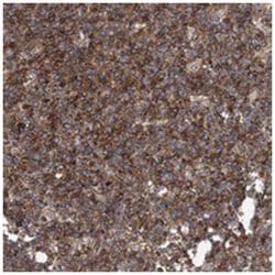 PISD Rabbit anti-Human, Polyclonal Antibody, Abnova 100 &mu;L | Buy Online | Abnova Corporation | Fisher Scientific