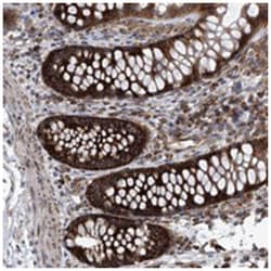 ZC3H15 Rabbit anti-Human, Polyclonal Antibody, Abnova 100&mu;L; Unlabeled:Antibodies,