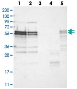 ZC3H15 Rabbit anti-Human, Mouse, Rat, Polyclonal Antibody, Abnova 100 &mu;L | Buy Online | Abnova Corporation | Fisher Scientific