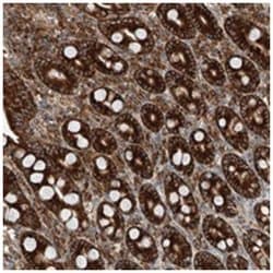 ZC3H15 Rabbit anti-Human, Mouse, Rat, Polyclonal Antibody, Abnova 100 &mu;L | Buy Online | Abnova Corporation | Fisher Scientific