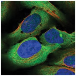 ZC3H15 Rabbit anti-Human, Mouse, Rat, Polyclonal Antibody, Abnova 100 &mu;L | Buy Online | Abnova Corporation | Fisher Scientific