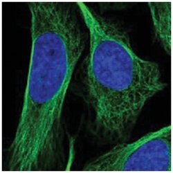 OFD1 Rabbit anti-Human, Polyclonal Antibody, Abnova 100 &mu;L | Buy Online | Abnova | Fisher Scientific