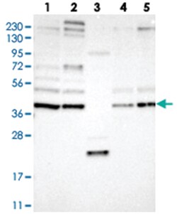 FRYL Rabbit anti-Human, Mouse, Rat, Polyclonal Antibody, Abnova 100 &mu;L | Buy Online | Abnova Corporation | Fisher Scientific