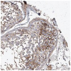 FRYL Rabbit anti-Human, Mouse, Rat, Polyclonal Antibody, Abnova 100 &mu;L | Buy Online | Abnova Corporation | Fisher Scientific
