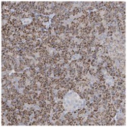 KCNV2, Rabbit, Polyclonal Antibody, Abnova 100 &mu;L | Buy Online | Abnova Corporation | Fisher Scientific