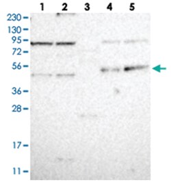 CDCP2, Rabbit, Polyclonal Antibody, Abnova 100 &mu;L | Buy Online | Abnova Corporation | Fisher Scientific