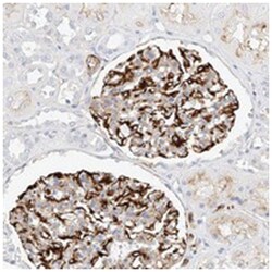 CDCP2, Rabbit, Polyclonal Antibody, Abnova 100 &mu;L | Buy Online | Abnova Corporation | Fisher Scientific