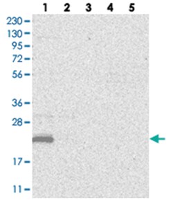 MOSPD1 Rabbit anti-Human, Polyclonal Antibody, Abnova 100 &mu;L | Buy Online | Abnova Corporation | Fisher Scientific