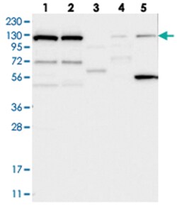 DNAJC6, Rabbit, Polyclonal Antibody, Abnova 100&mu;L; Unlabeled:Antibodies,