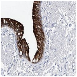 RSHL3 Rabbit anti-Human, Polyclonal Antibody, Abnova 100&mu;L; Unlabeled:Antibodies,