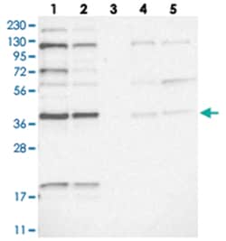 KTI12 Rabbit anti-Human, Polyclonal Antibody, Abnova 100&mu;L; Unlabeled:Antibodies,