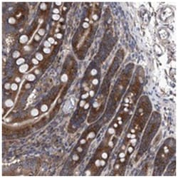 KTI12 Rabbit anti-Human, Polyclonal Antibody, Abnova 100&mu;L; Unlabeled:Antibodies,