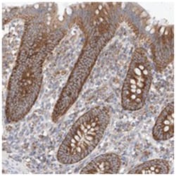KTI12 Rabbit anti-Human, Polyclonal Antibody, Abnova 100 &mu;L | Buy Online | Abnova Corporation | Fisher Scientific