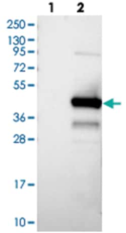 KTI12 Rabbit anti-Human, Polyclonal Antibody, Abnova 100 &mu;L | Buy Online | Abnova Corporation | Fisher Scientific