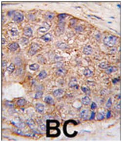 UBTD1, Rabbit, Polyclonal Antibody, Abnova 400&mu;L; Unlabeled:Antibodies,