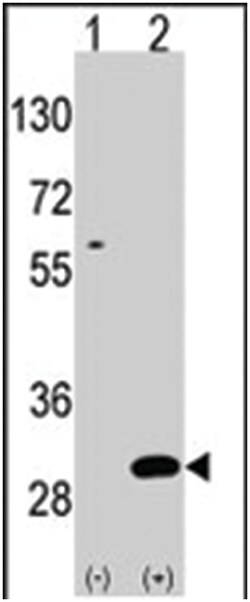 UBTD1, Rabbit, Polyclonal Antibody, Abnova 400&mu;L; Unlabeled:Antibodies,