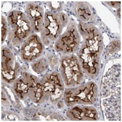 CLSTN2, Rabbit, Polyclonal Antibody, Abnova 100 &mu;L | Buy Online | Abnova Corporation | Fisher Scientific