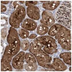 PPCS, Rabbit, Polyclonal Antibody, Abnova 100&mu;L; Unlabeled:Antibodies,