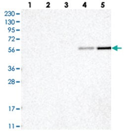 RMND1, Rabbit, Polyclonal Antibody, Abnova 100 &mu;L | Buy Online | Abnova Corporation | Fisher Scientific