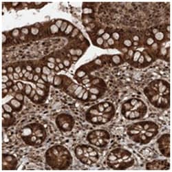 RMND1, Rabbit, Polyclonal Antibody, Abnova 100 &mu;L | Buy Online | Abnova Corporation | Fisher Scientific