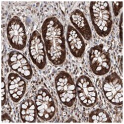 TIMM23, Rabbit, Polyclonal Antibody, Abnova 100 &mu;L | Buy Online | Abnova Corporation | Fisher Scientific