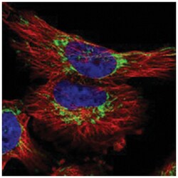 TIMM23, Rabbit, Polyclonal Antibody, Abnova 100 &mu;L | Buy Online | Abnova Corporation | Fisher Scientific