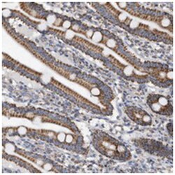 WFDC1, Rabbit, Polyclonal Antibody, Abnova 100&mu;L; Unlabeled:Antibodies,