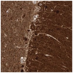 ZNF512, Rabbit, Polyclonal Antibody, Abnova 100 &mu;L | Buy Online | Abnova Corporation | Fisher Scientific