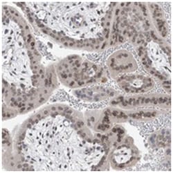 KRTAP25-1, Rabbit, Polyclonal Antibody, Abnova 100 &mu;L | Buy Online | Abnova Corporation | Fisher Scientific